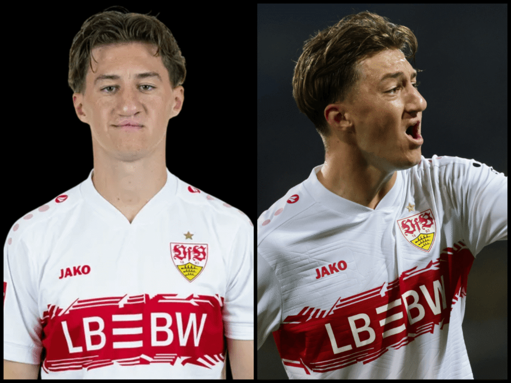 Angelo Stiller und seine Nase: Was wirklich dahinter steckt angelo stiller nase krankheit